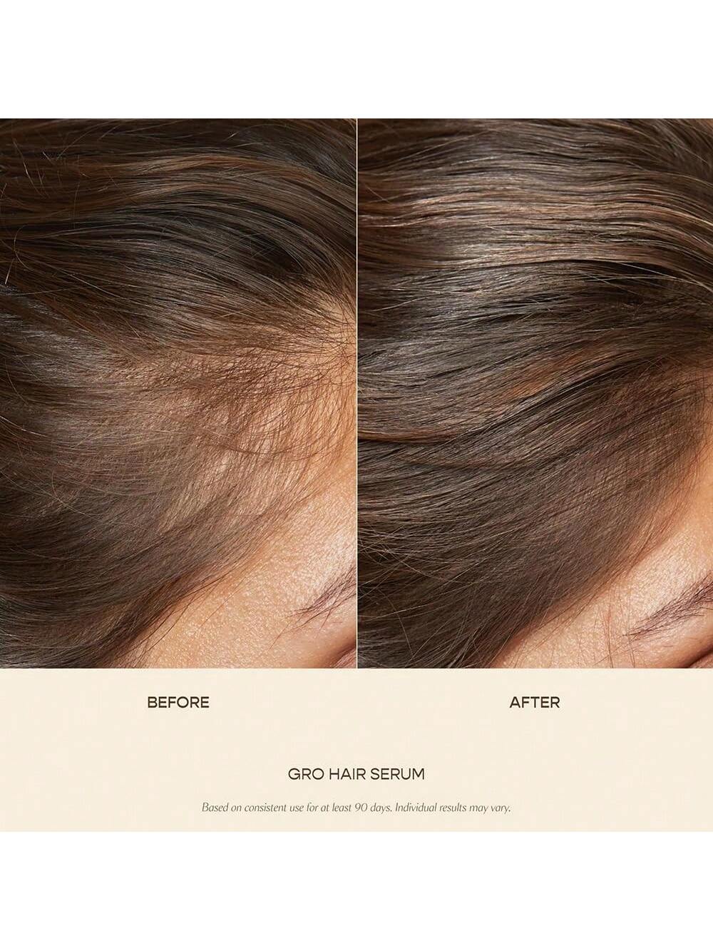 VEGAMO GRO Hair Serum For Hair Thinning