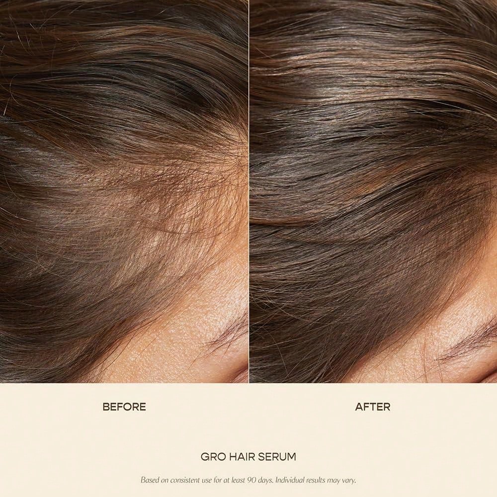 VEGAMO GRO Hair Serum For Hair Thinning